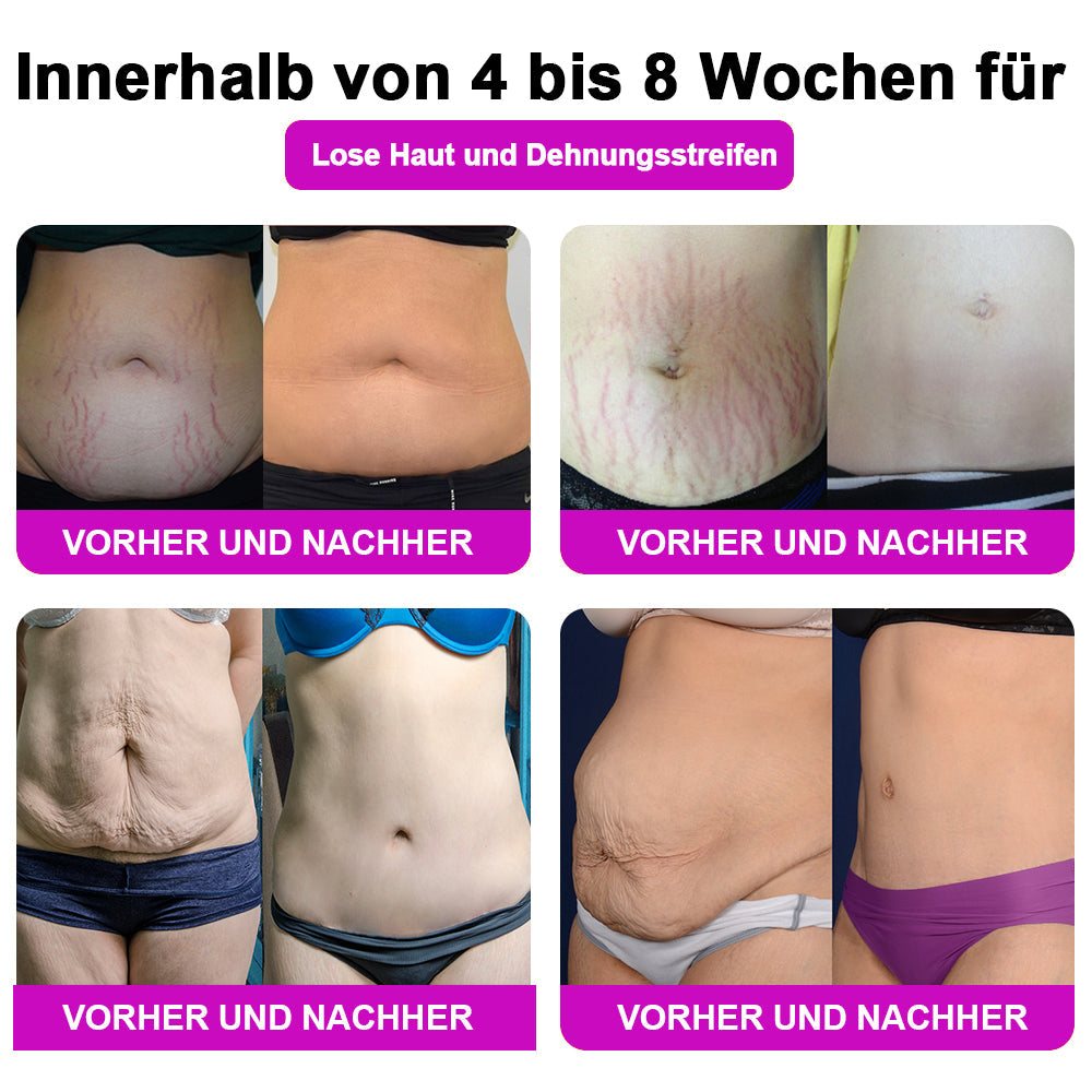 1+1 Gratis | IonsTech™ - Negative Ion Fettverbrennende, Bauchstraffende, Entgiftende Formhosen