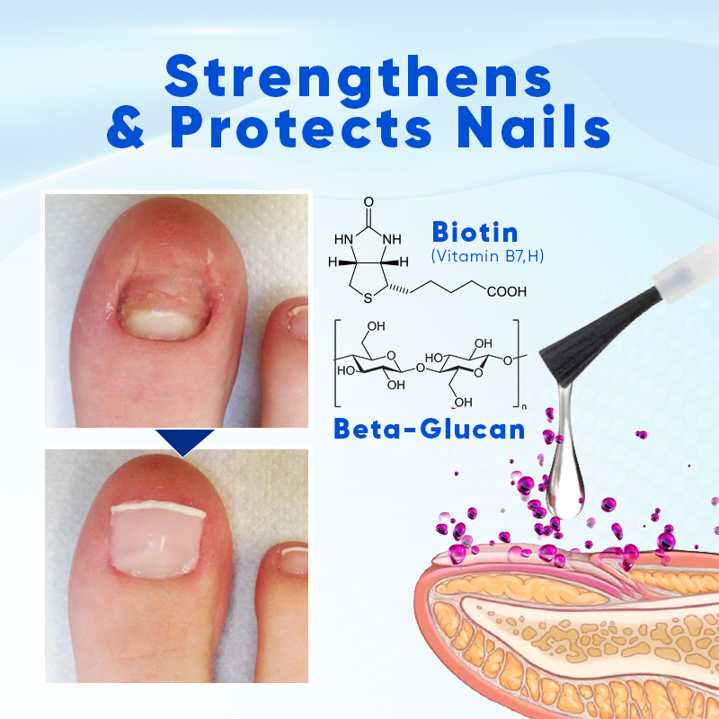 1+1 GRATIS | Biancat™ OnyxoGuard Nagelwachstums- und Reparaturserum — Belebt und stärkt Nägel schnell für gesündere, schönere Nägel