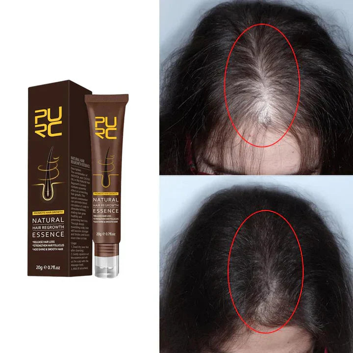 Wochsy -  Natürliches Haarwuchsöl | 1 + 1 GRATIS