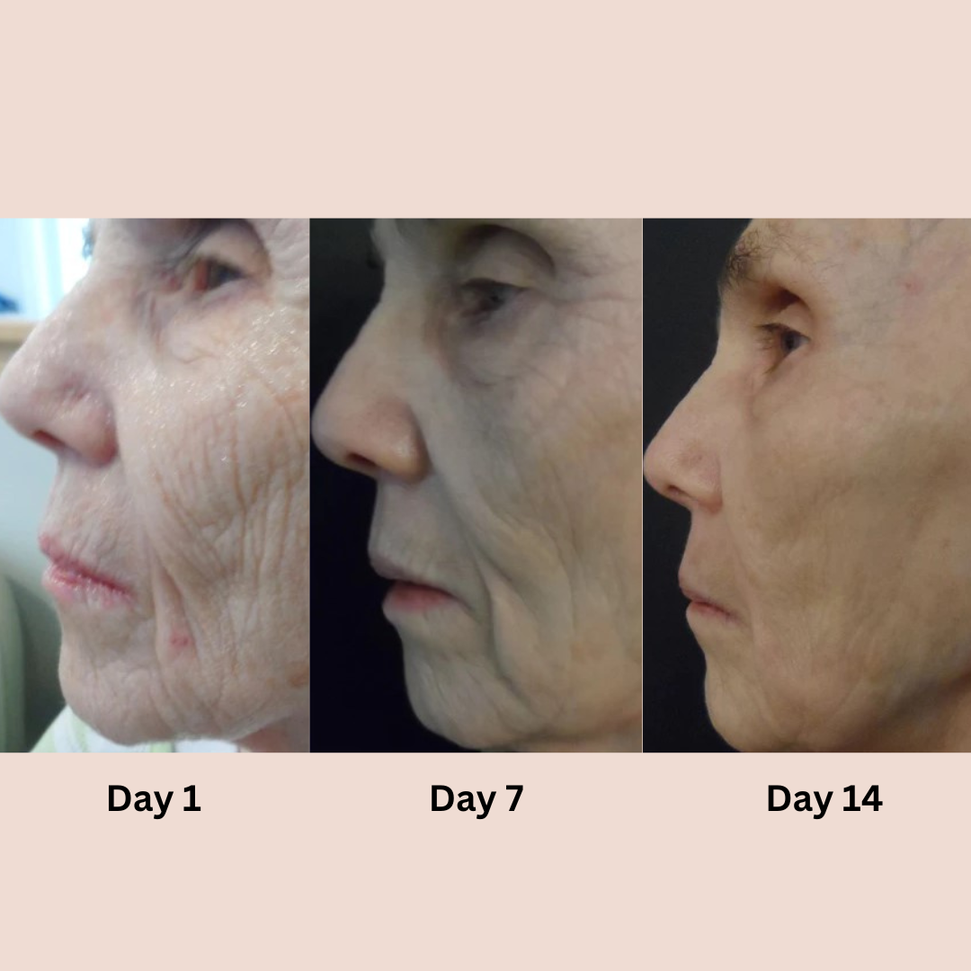 PrettyGlow™- Verjüngen Sie Ihre Augen!