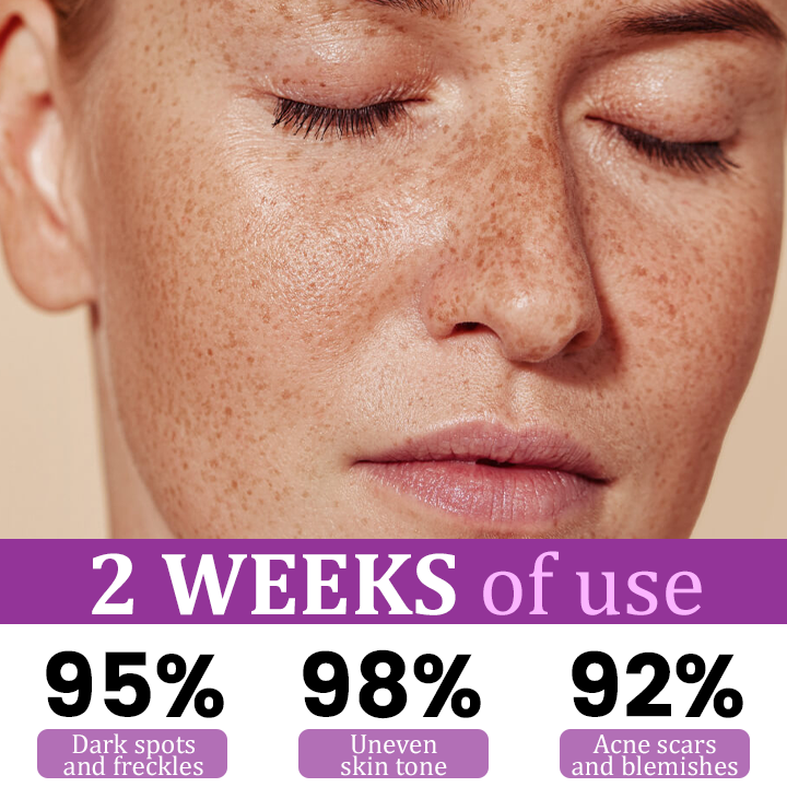 1+1 Gratis | Ceoerty™ MelantraX Fortgeschrittene Anti-Hyperpigmentations-Essenz — Enthüllen Sie strahlende, makellose Haut, die Sie lieben werden
