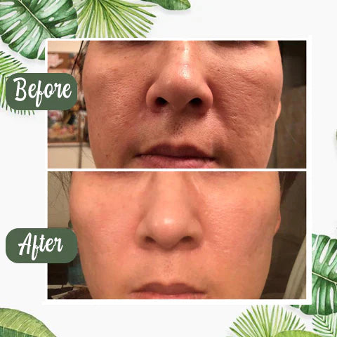 1+1 GRATIS | Poreless Deep Cleanse Mask Stick™ — Enthülle frische, strahlende Haut ohne Mitesser und Glanz