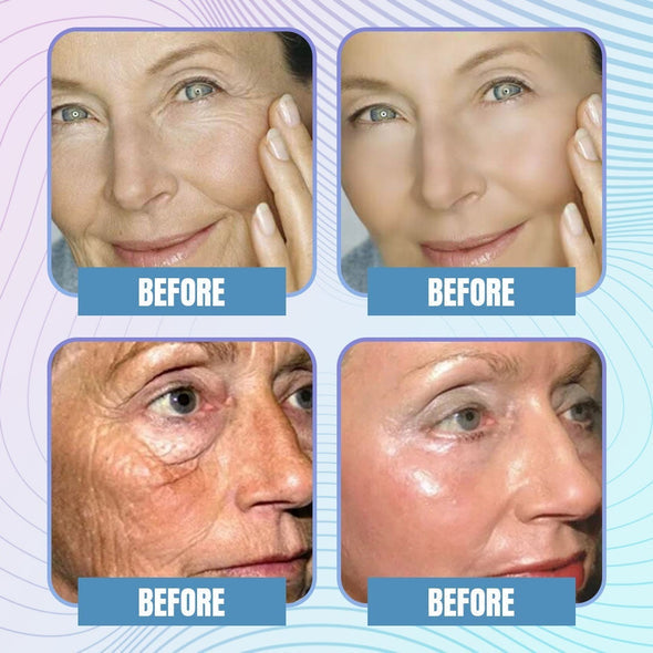 Youthful™️ Kollagen Sofort-Boost-Maske ( 5 Paar/10Stück )