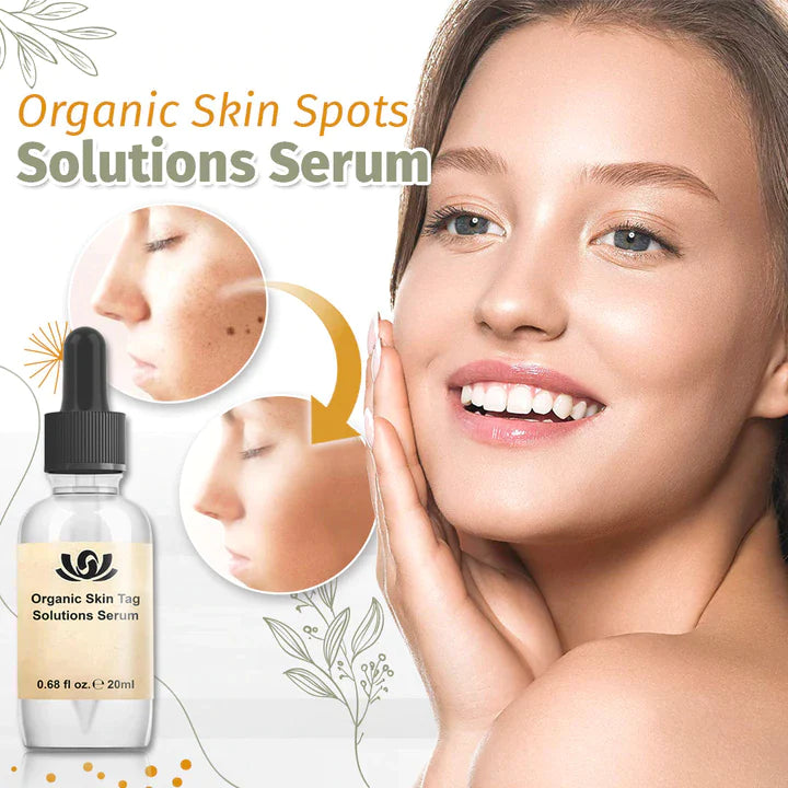 1+1 Gratis | SpotFree™ - Bio-Lösung für Hautunreinheiten Serum