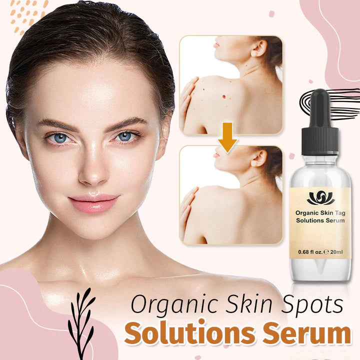 1+1 Gratis | SpotFree™ - Bio-Lösung für Hautunreinheiten Serum