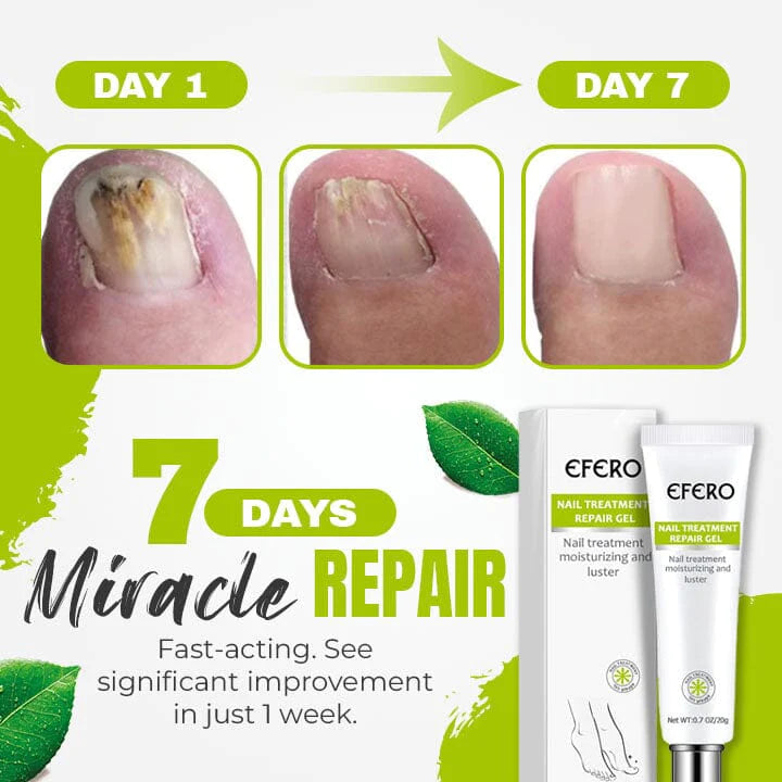 1+1 Gratis | Efero™ Nagelbehandlung Reparatur Gel