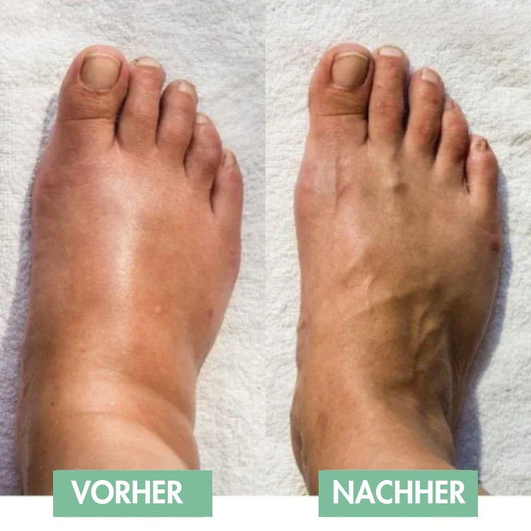 SoleVibe™ — Schmerzen in den Füßen lindern und jeden Schritt neu beleben