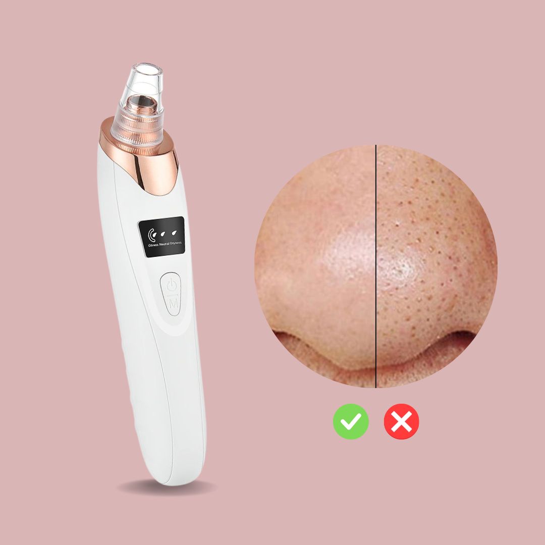 SkinSpa™ Mitesser-Entferner