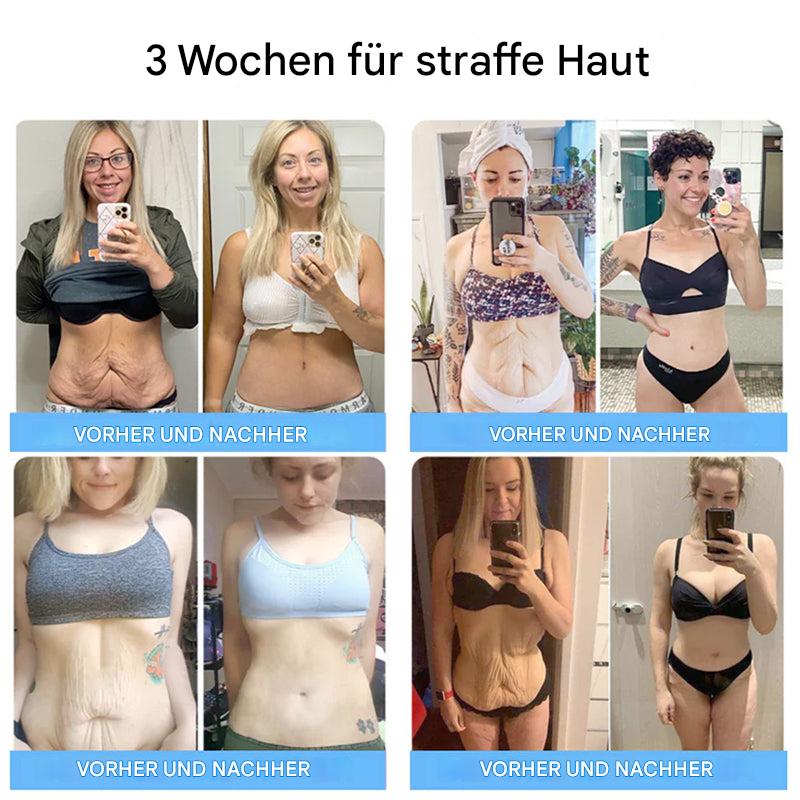 1+1 Gratis | Liftora™ Straffen und festigen Sie Ihre Haut ohne Operation