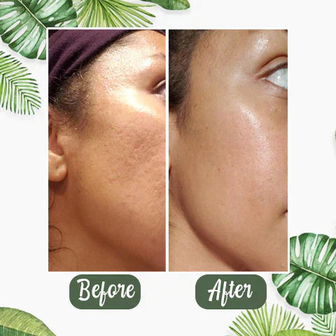 1+1 GRATIS | Poreless Deep Cleanse Mask Stick™ — Enthülle frische, strahlende Haut ohne Mitesser und Glanz