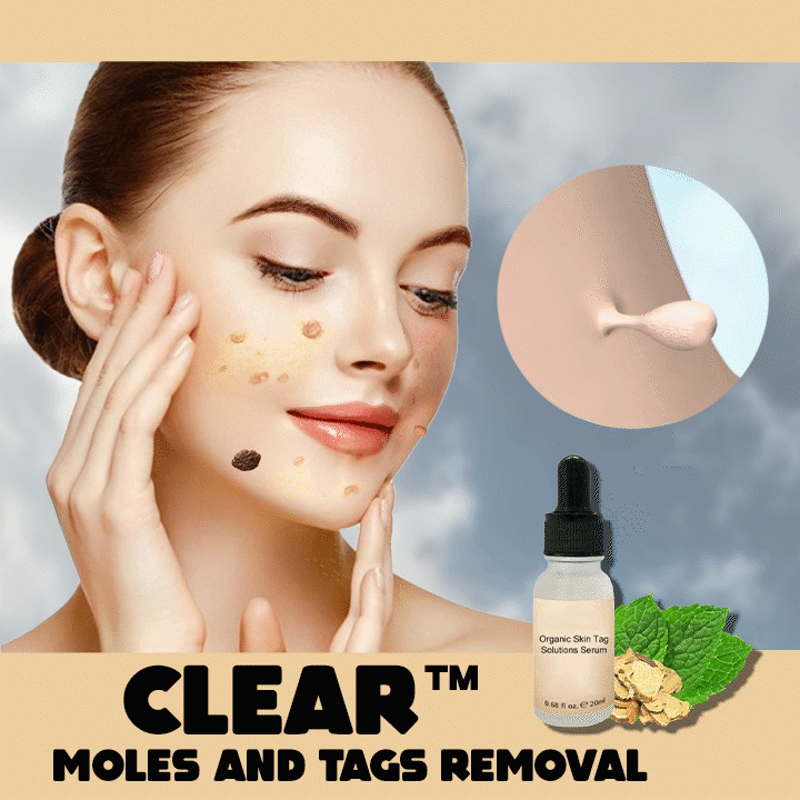 Spotless Skin Serum™-  Organisches Serum zur Lösung von Hautflecken