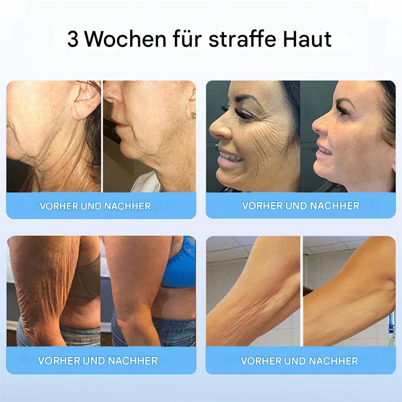 1+1 Gratis | Liftora™ Straffen und festigen Sie Ihre Haut ohne Operation