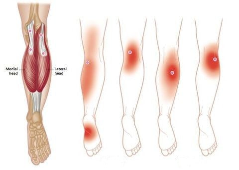 Self-heating ™ | Kniebandage: schnelle Linderung von Schmerzen