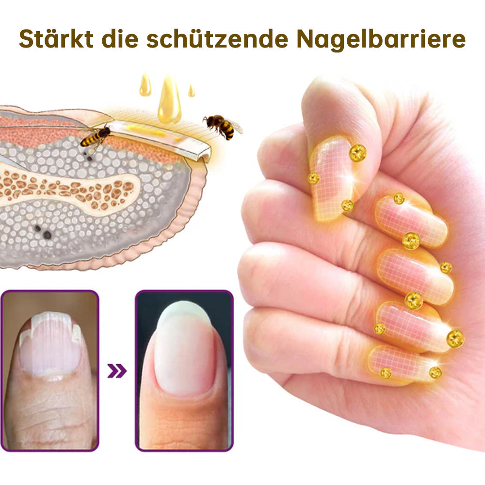 1+1 GRATIS | FungiFree™ Fungus-Free Bienengift-Nagelbehandlungsserum