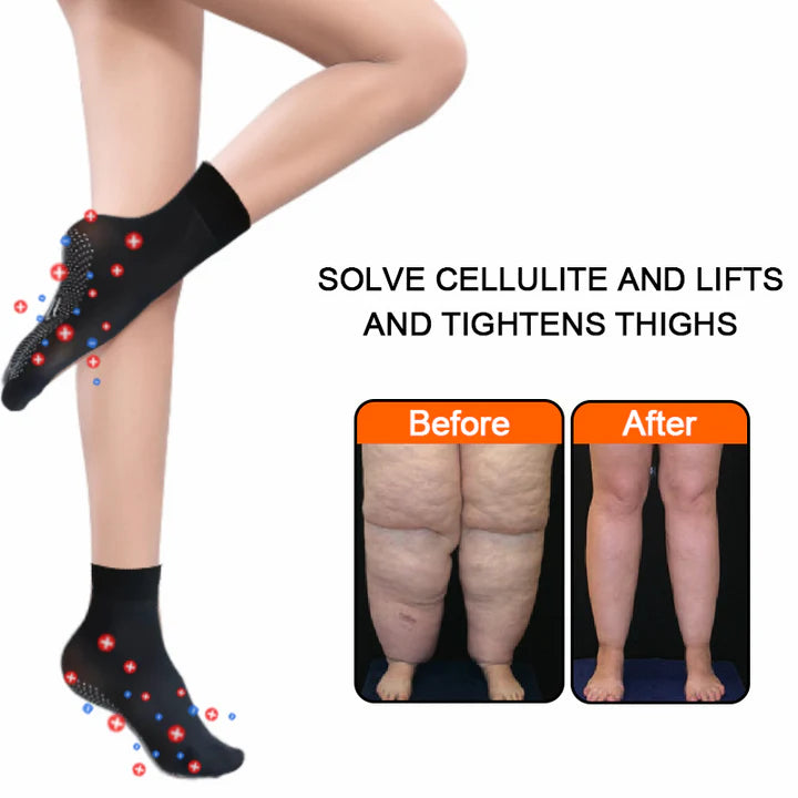 1+2 Gratis | ShapeSocks™ - Der ultimative Hack zur Beschleunigung Ihrer Gewichtsabnahme!