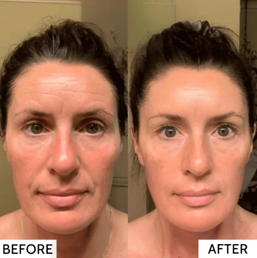 50% RABATT TEMPORÄR | RevitaMask™ | Genieße eine straffe & strahlende Haut!