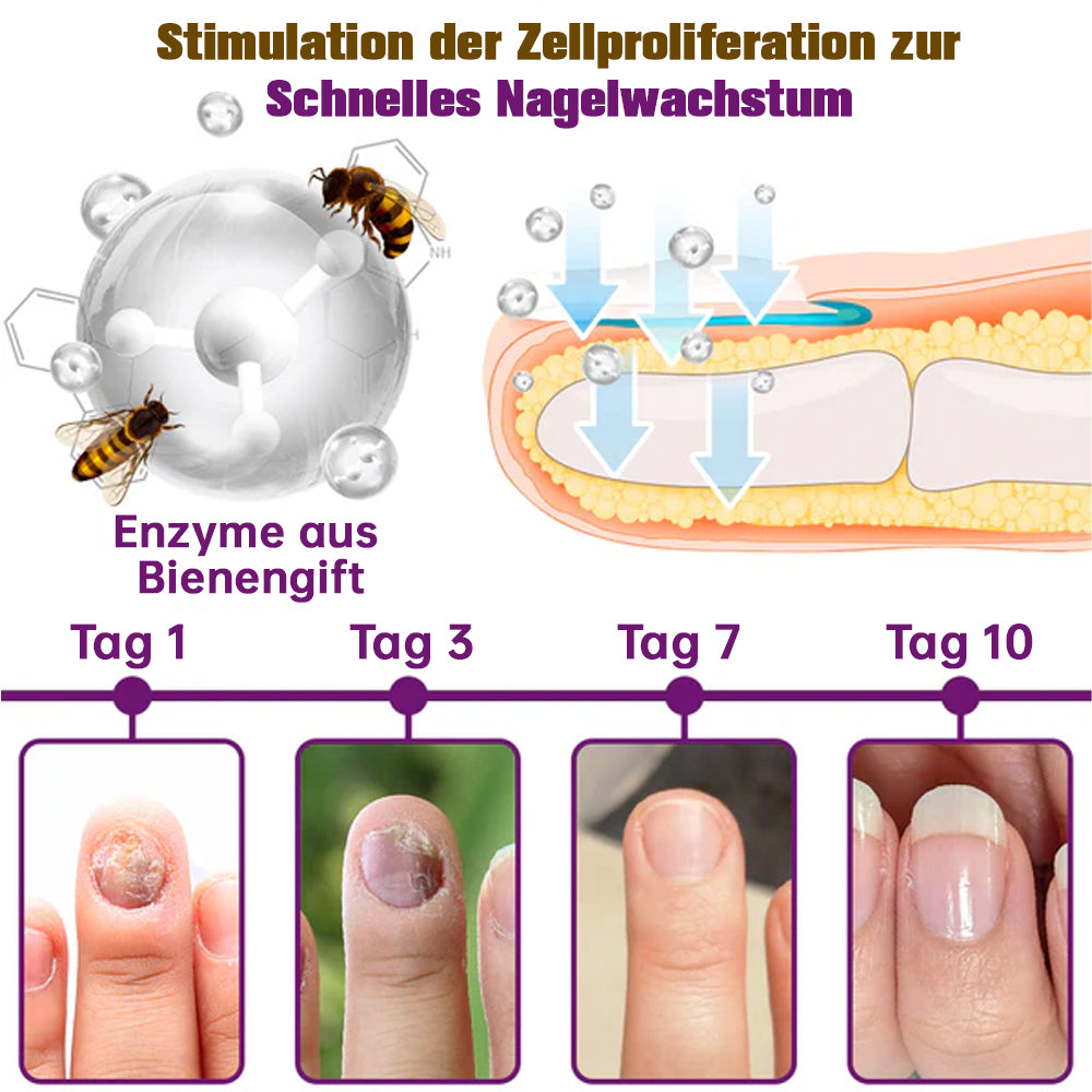 1+1 GRATIS | FungiFree™ Fungus-Free Bienengift-Nagelbehandlungsserum