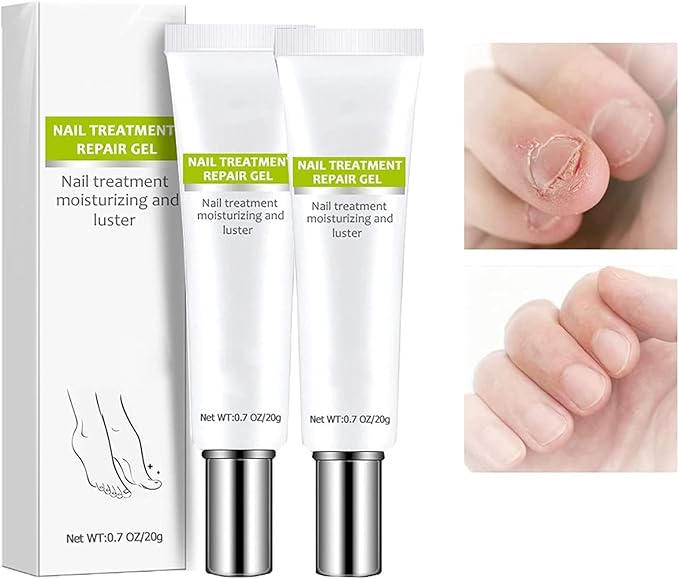 1+1 GRATIS | RejuveNail™ - Steigert die Kraft für gesunde, schöne Nägel!