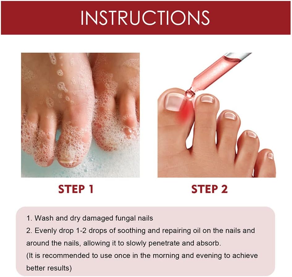 1+1 Gratis | HealNail™ Reparatur beschädigter Nägel in 4 Wochen