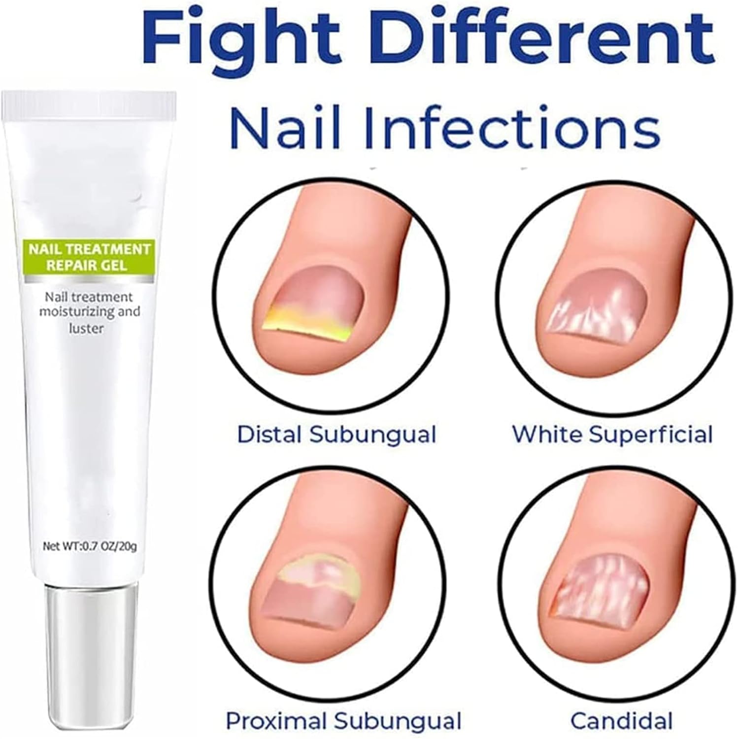 1+1 GRATIS | RejuveNail™ - Steigert die Kraft für gesunde, schöne Nägel!