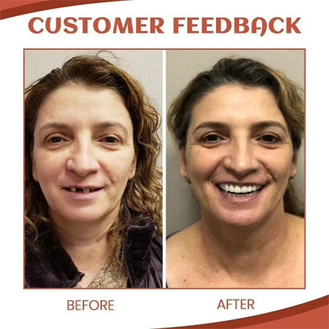 SiliconeAdjust Zahnersatz-Kit | Individuell Anpassbar | Schmerzfrei & Komfortabel