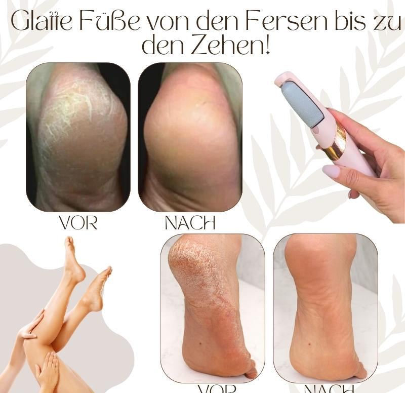 CallusPro™ - Elektrischer Hornhautentferner