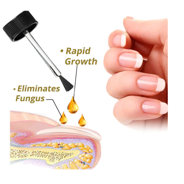 1+1 Gratis | NailRevitalize™ Intensives Nagelwachstums- und Stärkungsserum