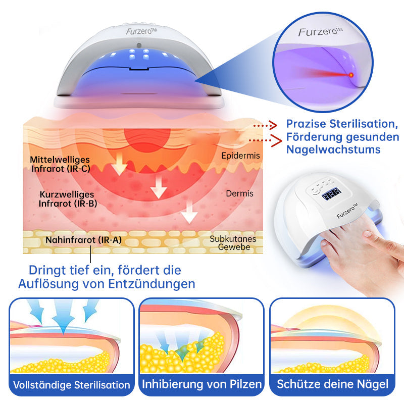 NailCure™ - Nagelpilz-Laserbehandlung Lösung (50% RABATT)