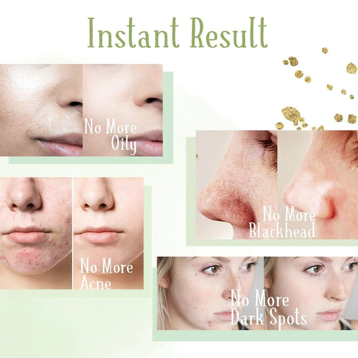 1 + 1 GRATIS HEUTE | La'Pure™ Grüner Tee Poren-Reinigungsstift