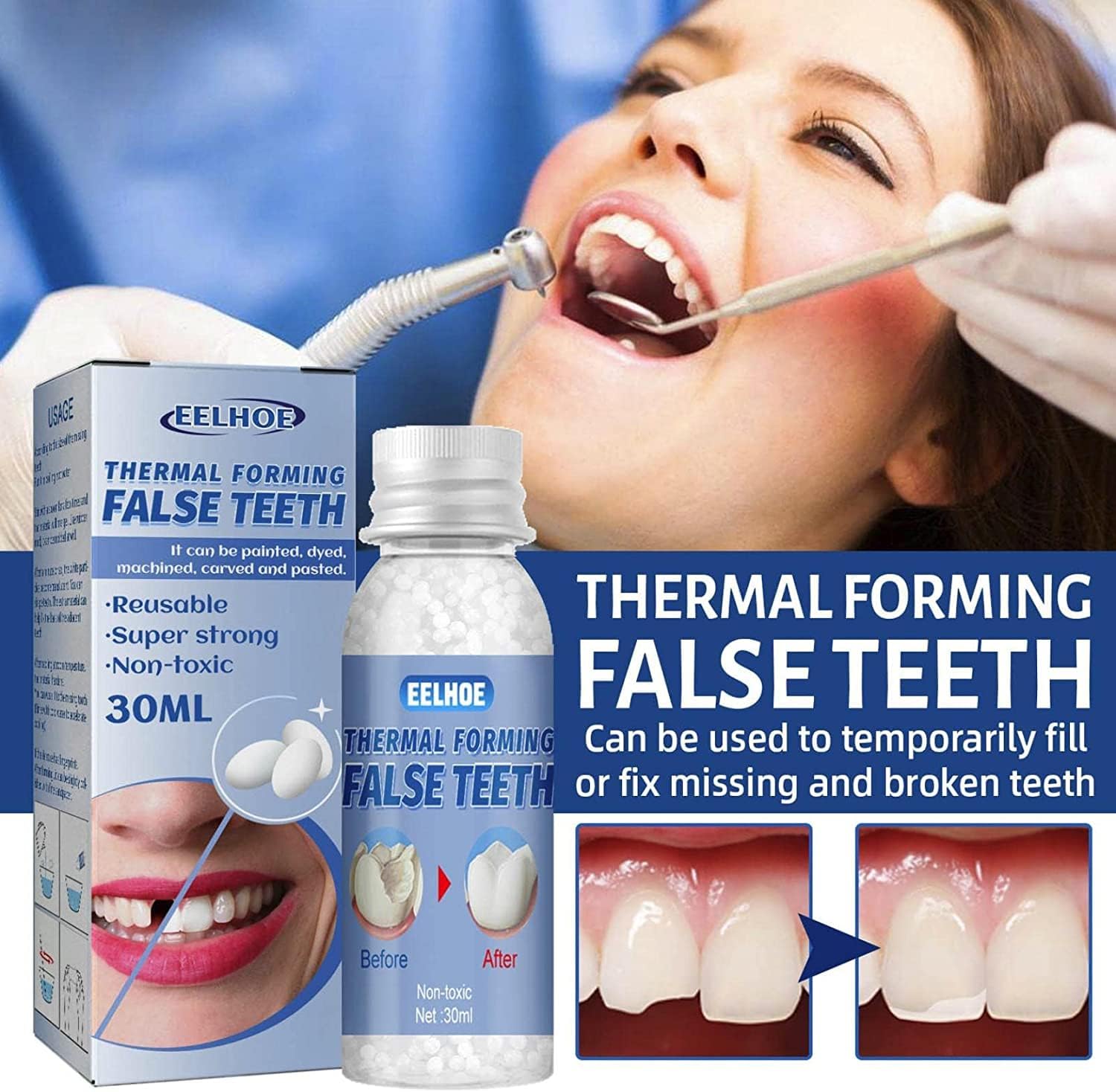 SmileRight Zahnreparatur Set | Sofort Zahnlücken Füllen | Natürliche Farbe | 1+1 Gratis