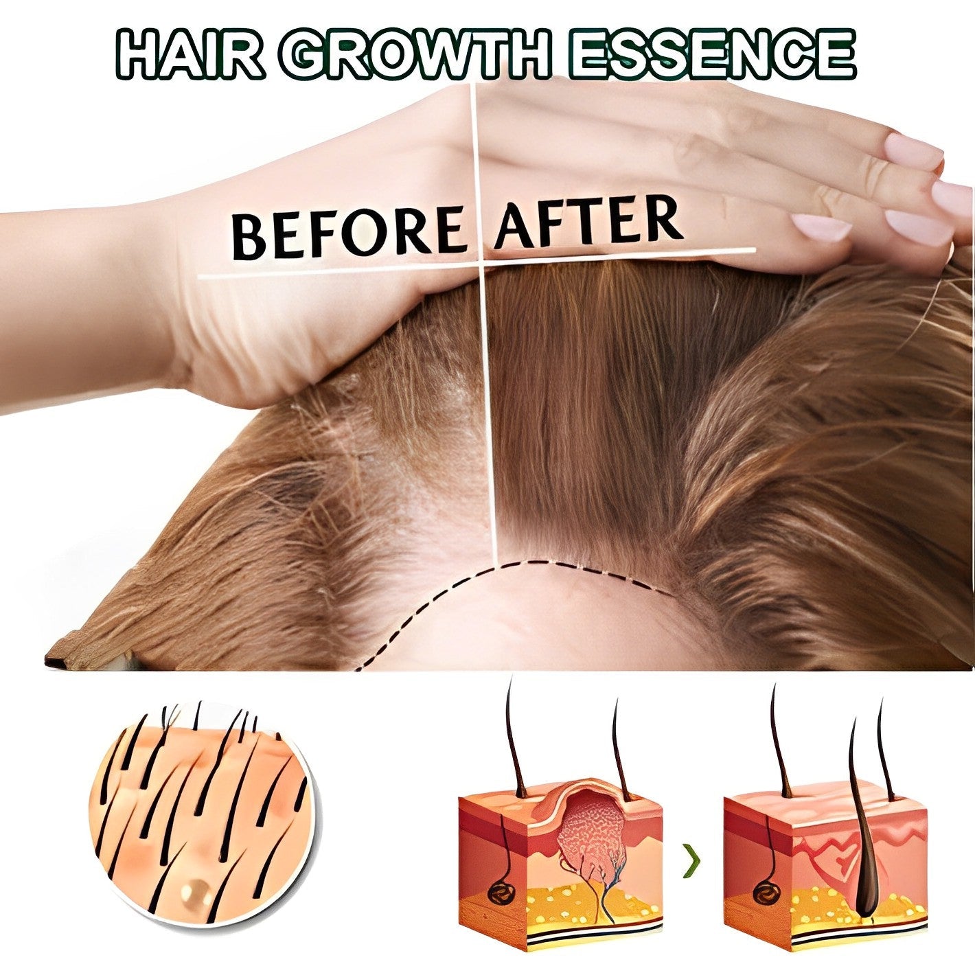 HairGrowth™ - Volleres Haar auf natürliche Weise