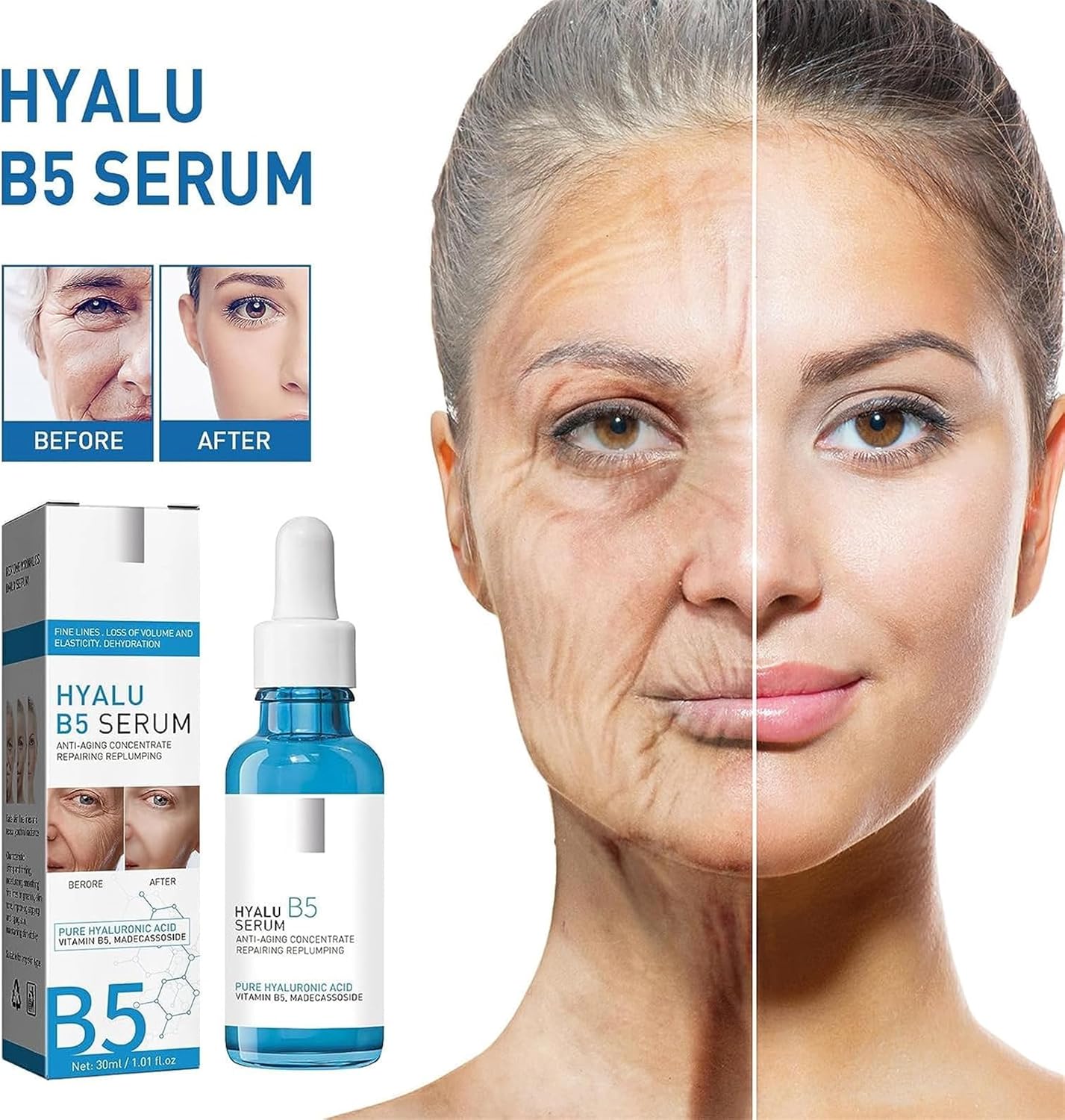 1+1 GRATIS | Hyalu™ Jugendliche Ausstrahlung wiederherstellen
