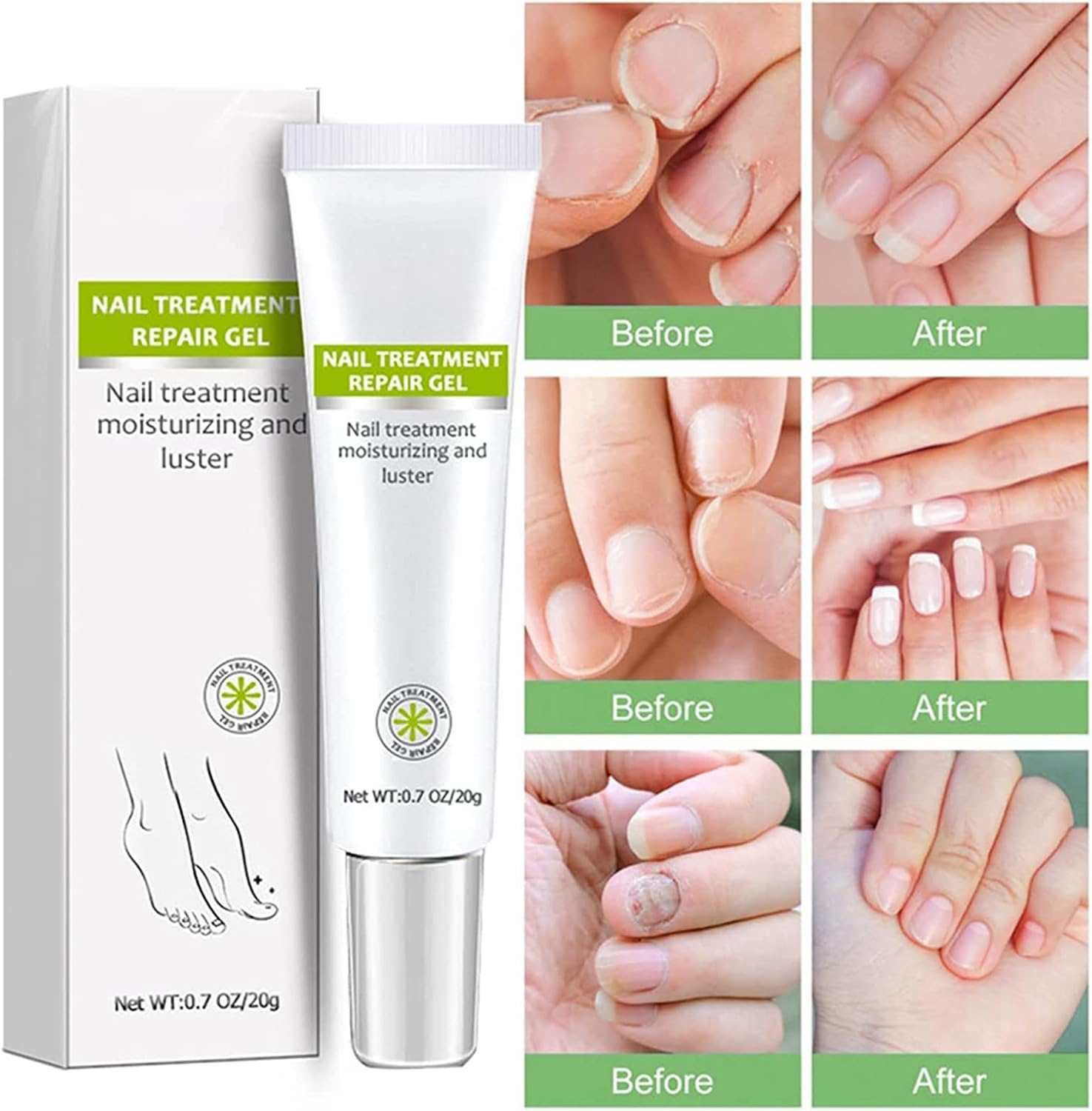 1+1 GRATIS | RejuveNail™ - Steigert die Kraft für gesunde, schöne Nägel!