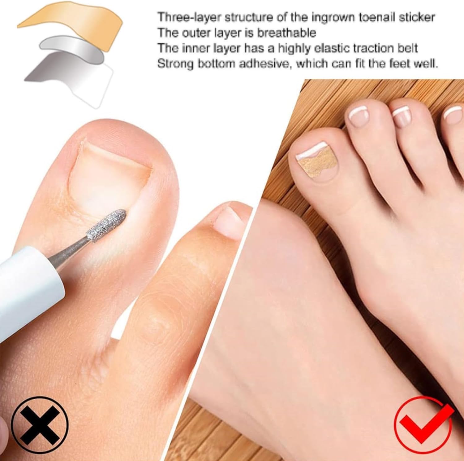 Nagelkorrekturpflaster | Schutz & Regeneration | Perfekte Nägel