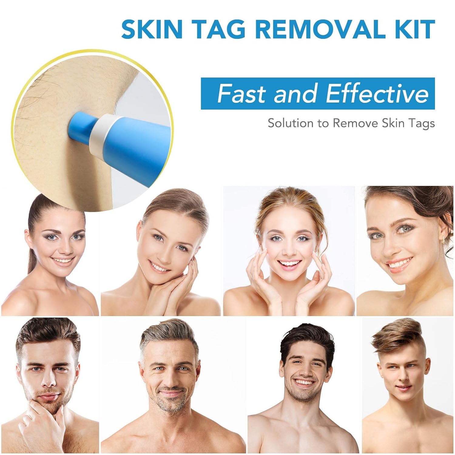 FlawFix™ | Stielwarzen Entfernungsset
