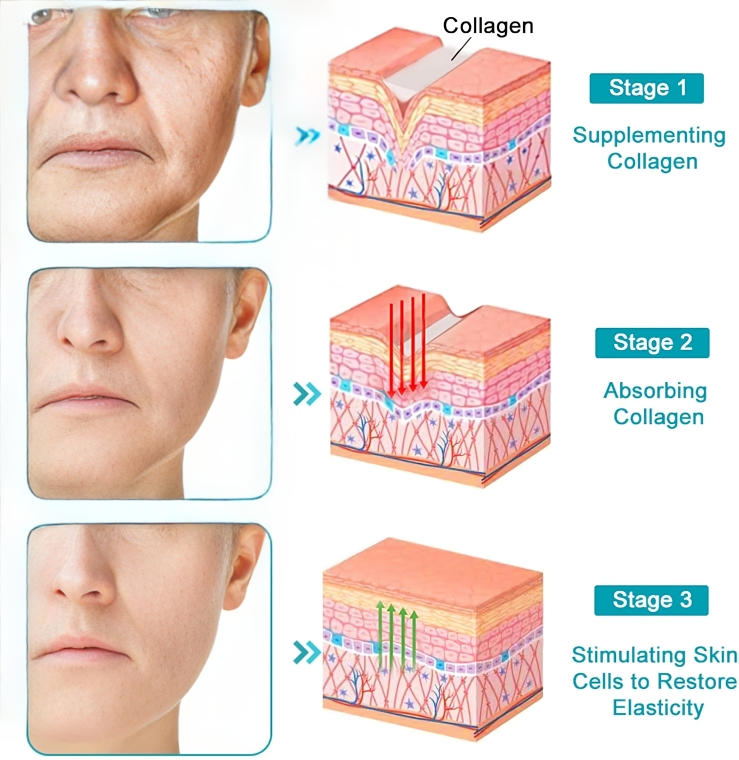1 + 1 GRATIS HEUTE | RevitaStick™ | Ihr Geheimnis für straffere, elastischere Haut!