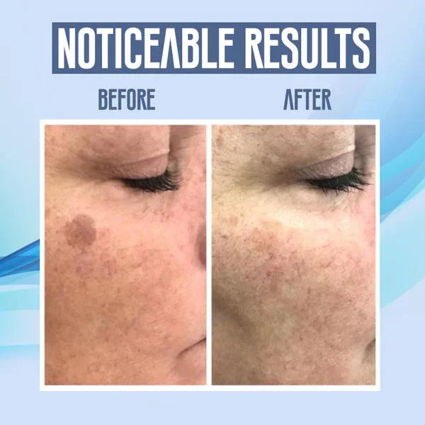 ClearRadiance™ — Unreinheiten wegzaubern für jeden Tag strahlend makellose Haut