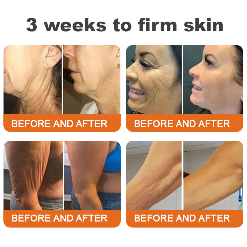 1+1 Gratis | LOVILDS™ Botulinum Toxin Bienengift straffendes Serum-Stift – Verwandeln Sie Ihre Haut in nur 7 Tagen mit Festigkeit und jugendlichem Strahlen