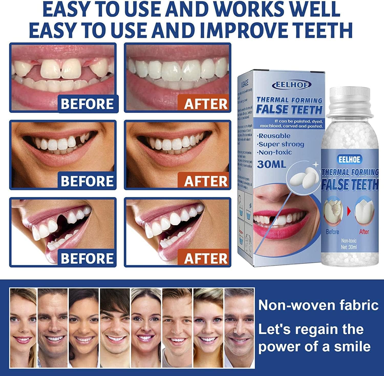 SmileRight Zahnreparatur Set | Sofort Zahnlücken Füllen | Natürliche Farbe | 1+1 Gratis