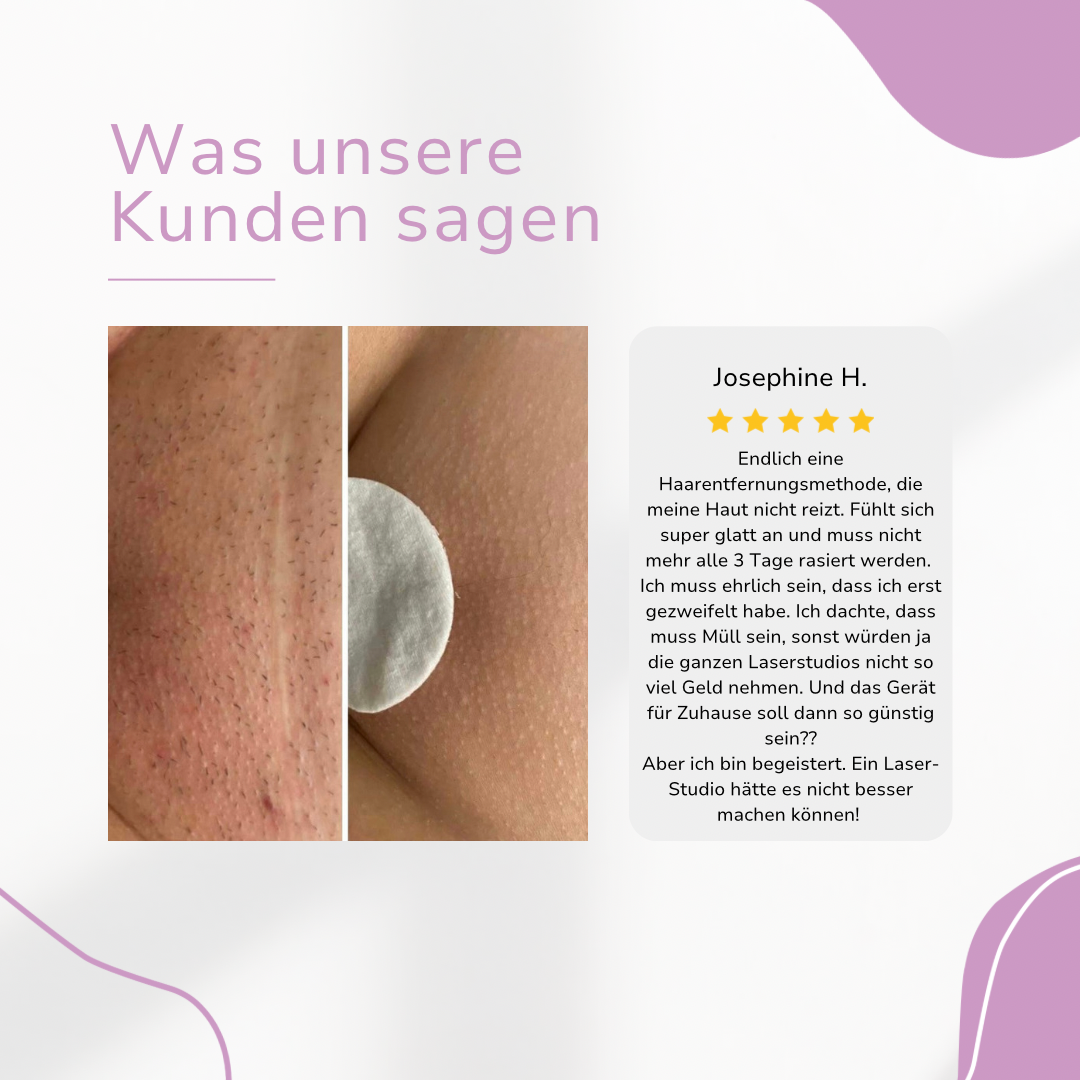 Ylvis IPL Hair Remover I Die führende Laser-Haarentfernung für Zuhause