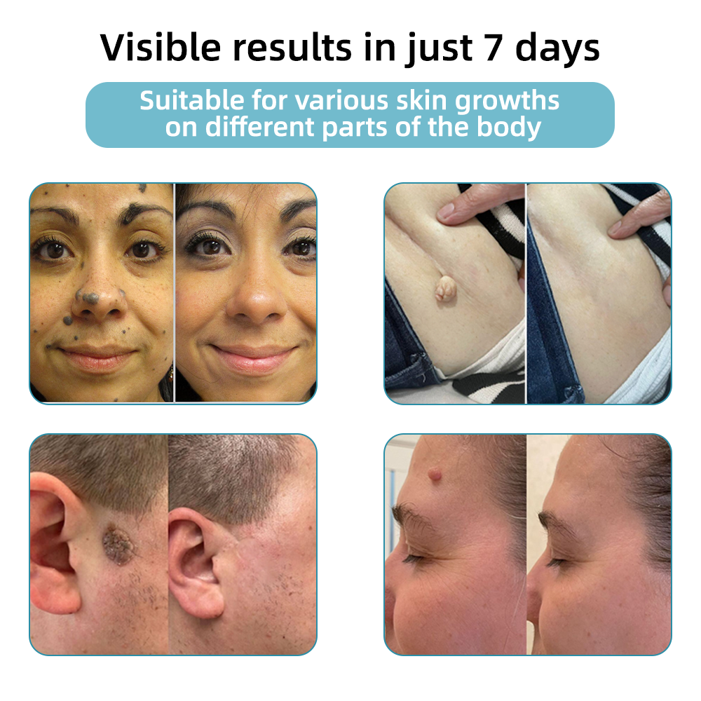 LumiDerm™ – Enthülle strahlende, makellose Haut und schnelles Selbstvertrauen