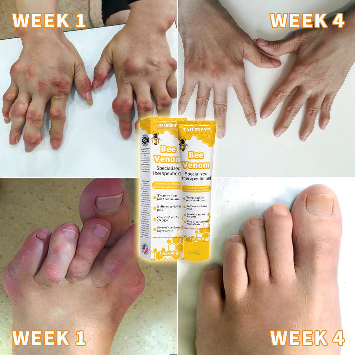 1+1 Gratis | TAILEDEN™ Bienengift Gelenktherapie Schmerzgel – Befreie dich von Schmerzen und erlange aktive Freude zurück