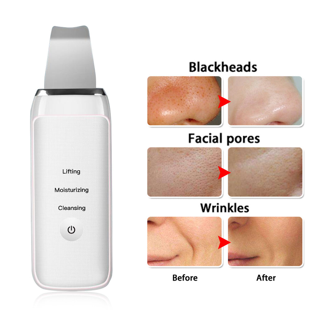 SkinRelief™ - Effektive Hautstraffung
