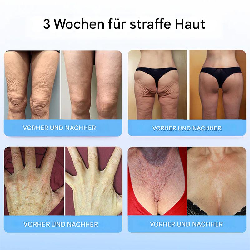 1+1 Gratis | Liftora™ Straffen und festigen Sie Ihre Haut ohne Operation