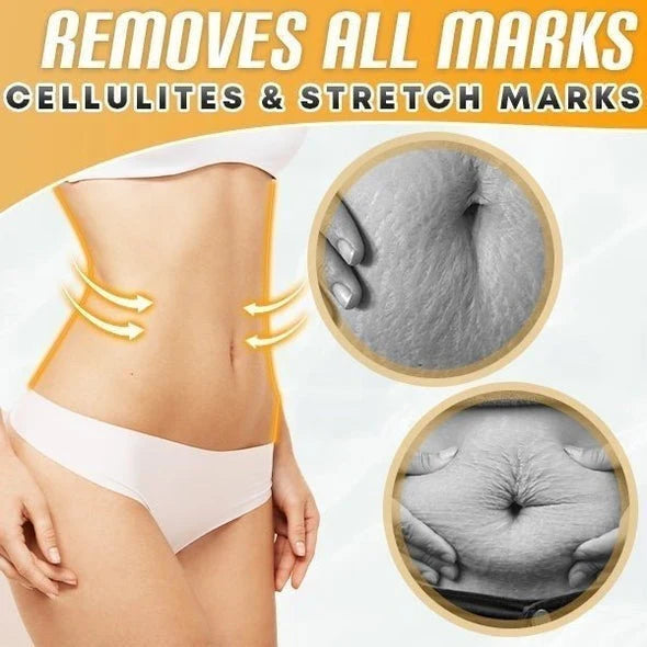 1+1 Gratis | Belly Drainage Ginger Oil - Mit natürlichen Ölen hergestellt, um Cellulite sicher zu verbrennen!