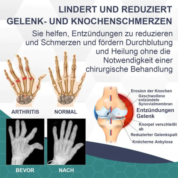 Bienengift Schmerzcreme | Wohltuende Pflege für Gelenke & Muskeln | Tiefenwirksame Formel