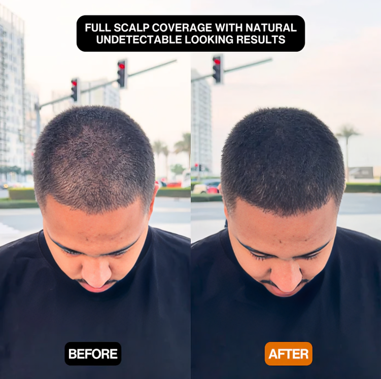 CoverEdge™ | Eine schnelle Lösung für einen natürlichen, voluminösen Haaransatz!