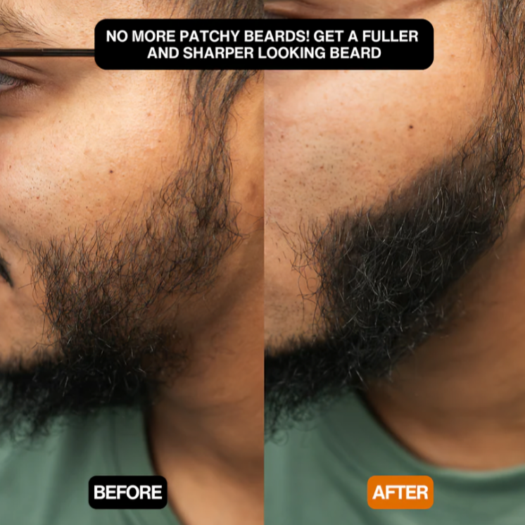 CoverEdge™ | Eine schnelle Lösung für einen natürlichen, voluminösen Haaransatz!