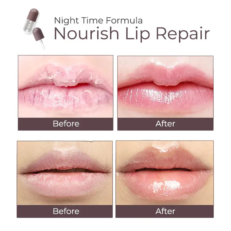 Derol™ - Lip Plumper Kit (50% RABATT)