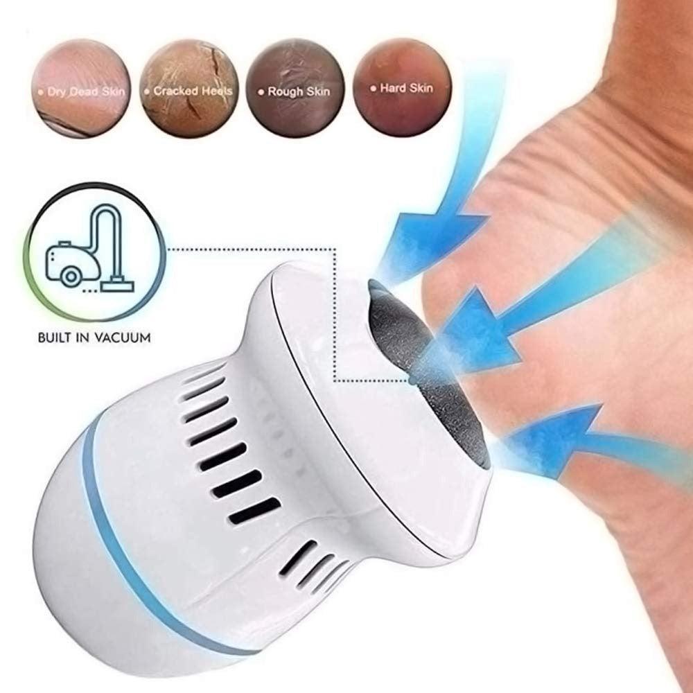 Silksole™ - Wiederaufladbarer elektrischer Fußhauttrimmer